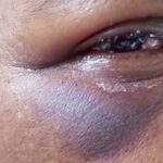 Devi, 56 ans, violemment agressée par un voleur