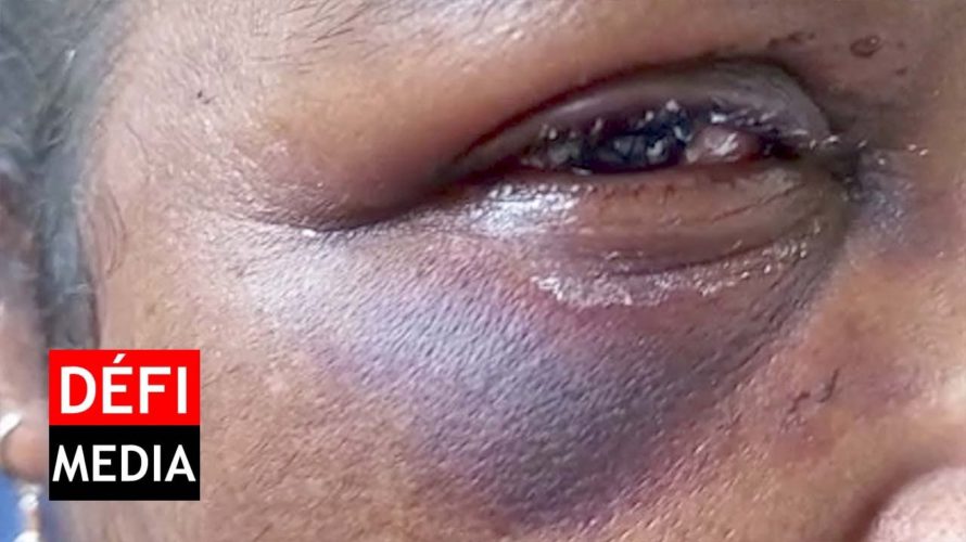 Devi, 56 ans, violemment agressée par un voleur